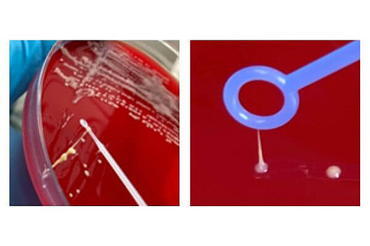 Zwei Aufnahmen von Trägermaterial auf einer Petrischale, man sieht eine Pipette, die Schleimfäden hinter sich her zieht. 