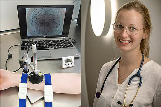 Der Versuchsaufbau zur Durchführung des β-adrenergen Schweißsekretionstests, den Dr. Pallenberg und AG für die CF-Diagnostik erforschen. Foto: Mukoviszidose e.V.