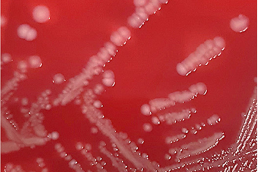 Staphylococcus aureus Kolonien auf Blutagarplatten.