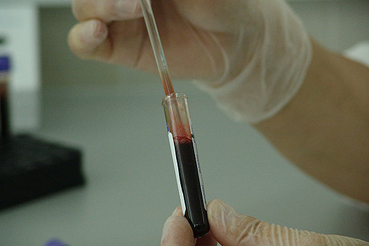 Bei der nicht-invasiven Pränataldiagnostik werden embryonale DNA-Schnipsel aus dem mütterlichen Blut untersucht. (Bild: Pixabay: PublicDomainPictures) Bei der nicht-invasiven Pränataldiagnostik werden embryonale DNA-Schnipsel aus dem mütterlichen Blut untersucht. (Bild: Pixabay: PublicDomainPictures)