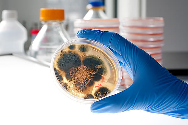 Der Schimmelpilz Aspergillus fumigatus kann für Mukoviszidose-Betroffene gefährlich sein. Foto: Martin Kaiser