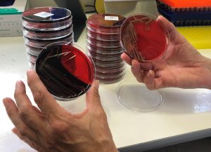 Staphylococcus aureus auf Agarplatten