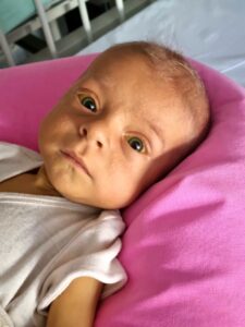 Joschua kurz vor der Transplantation