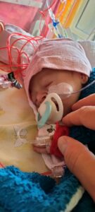 Feenja im Krankenhaus nach ihrer Geburt