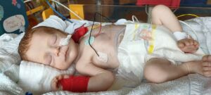 Feenja musste nach der Geburt direkt operiert werden, da sie einen Mekonium-Ileus hatte.