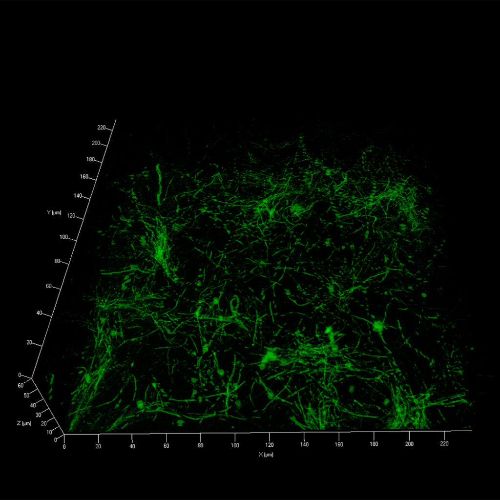 P. aeruginosa-Biofilme (grün), die mit dem Antibiotikum Meropenem behandelt wurden. Mithilfe der Mikroskopie kann das Biofilm-Wachstum von P. aeruginosa unter dem Druck der Therapie mit Meropenem im 3-D-Bildformat beobachtet werden. Foto: Mukoviszidose e.V.