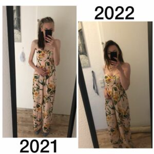 Vorher - nachher: 2021 war Lisas gesundheitlicher Tiefpunkt. Heute geht es ihr wieder viel besser - auch Dank Kaftrio.