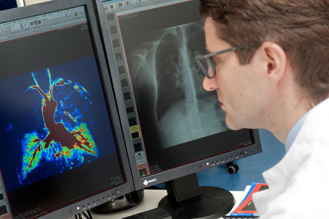 Prof. Mark Wielpütz bei der Auswertung von MRT-Scans der Lunge von CF-Betroffenen. Foto: Peggy Rudolph. 