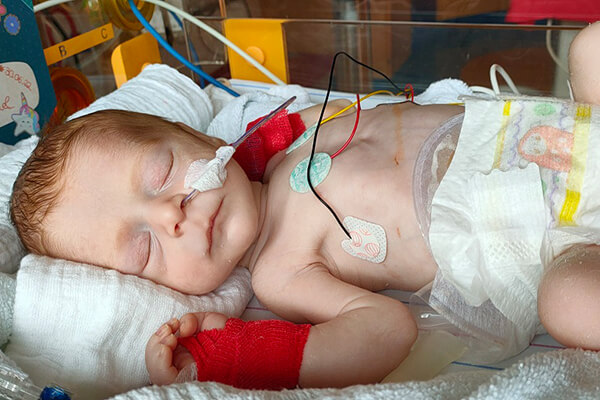 Feenja nach der Geburt im Krankenhaus Baby mit Schläuchen in der Nase und Elektroden auf der Brust: Feenja nach der Geburt im Krankenhaus